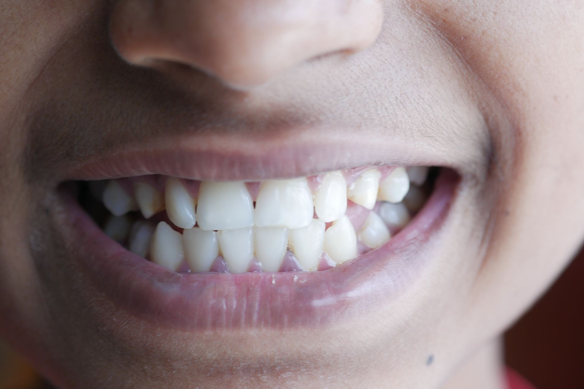 Close-up of a person's smile highlighting healthy teeth and lips.